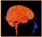 neurokid