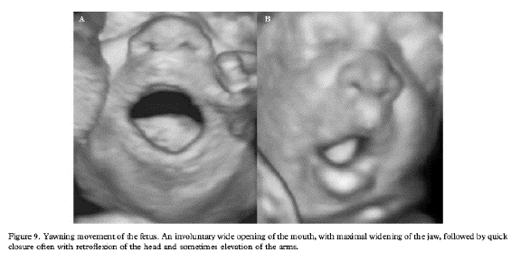 fetal yawn