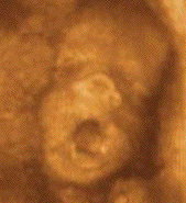 fetal-yawn